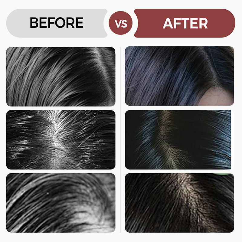 🔥Newly Developed Deep Moisturizing Conditioner